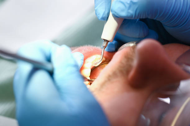 Best Orthodontic Emergency Dentist in Oildale, CA